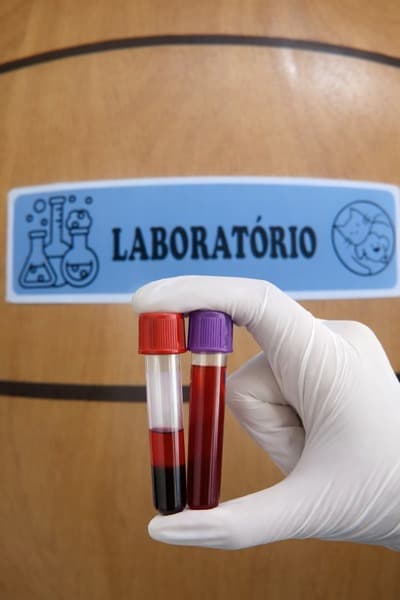 Quanto Custa um Exame de Sangue para Cachorro?
